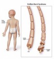 /album/fotogaleria/el-sindrome-de-guillain-barre-jpg/